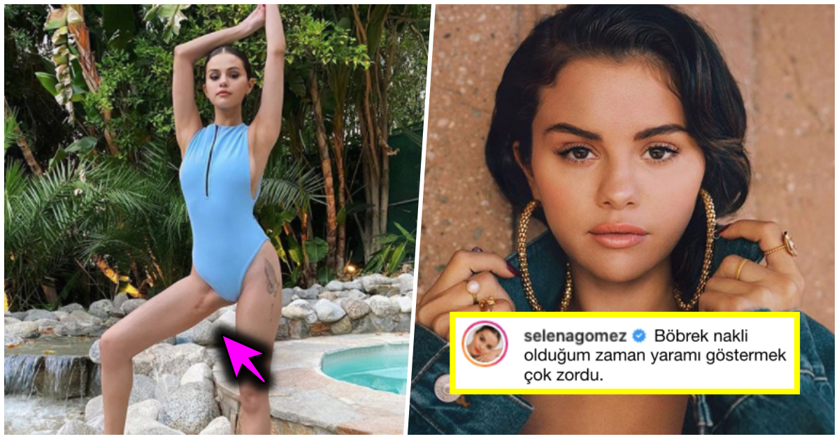 2017 Yılında Böbrek Nakli Olan Selena Gomez Yıllar Sonra İlk Defa Ameliyat İzini Gösterdi!