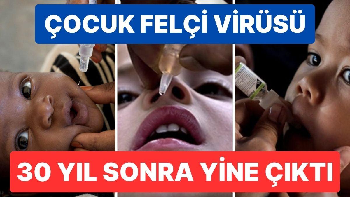 Çocuk Felci Virüsü 30 Yıl Sonra Yine Ortaya Çıktı