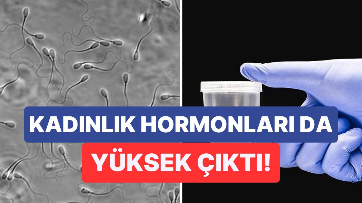 Yapılan Araştırmalar Sonucunda Farklı Alanlarda Çalışan Erkeklerin Sperm Sayısının Değiştiği Ortaya Çıktı