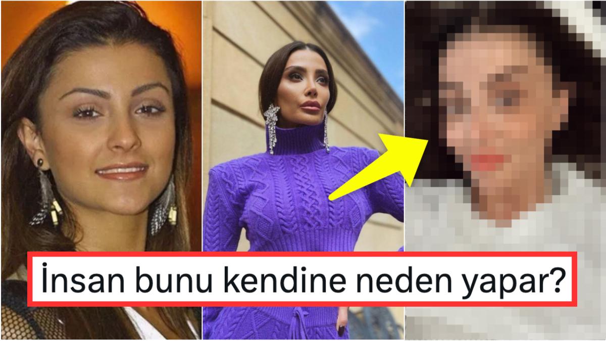 Geçirdiği Estetik Operasyonlarla Yıllar İçinde Değişik Birine Dönüşen Özge Ulusoy'ın Son Hali