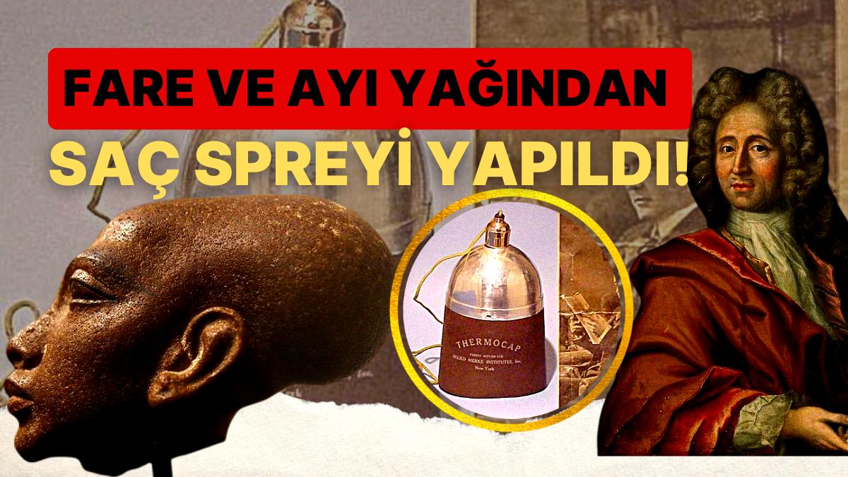 'Kel Kalsam Daha İyiydi' Diyeceğiniz Tarih Boyunca Uygulanmış Birbirinden Acayip Kellik Tedavileri