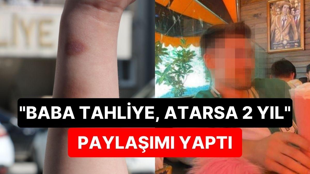 Münasebet Teklifini Reddeden Sevgilisini Darbetti: "Baba Tahliye, Atarsa 2 Yıl"