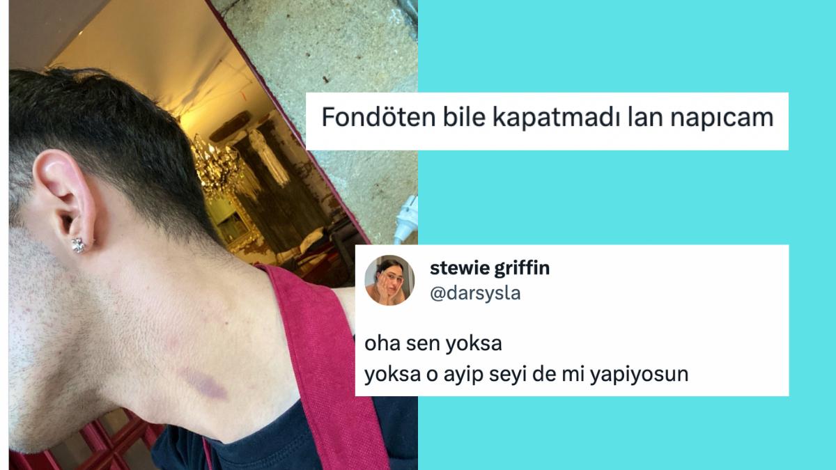 Boynundaki "Seviştim" İzini Kapatmak İçin Tavsiye İsteyen Twitter Kullanıcısına Gelen Komik Reaksiyonlar