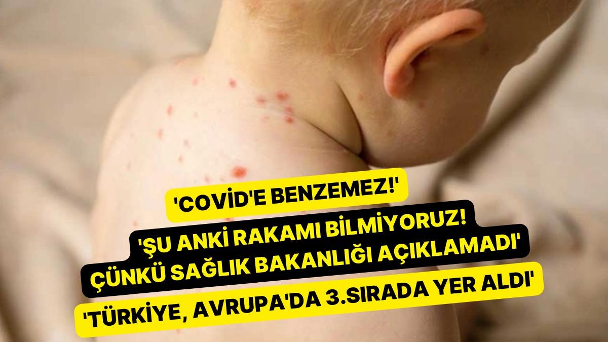 Çocuk Vefatları Başladı: Kızamık Nedeniyle İstanbul'da 2 Çocuk Hayatını Yitirdi