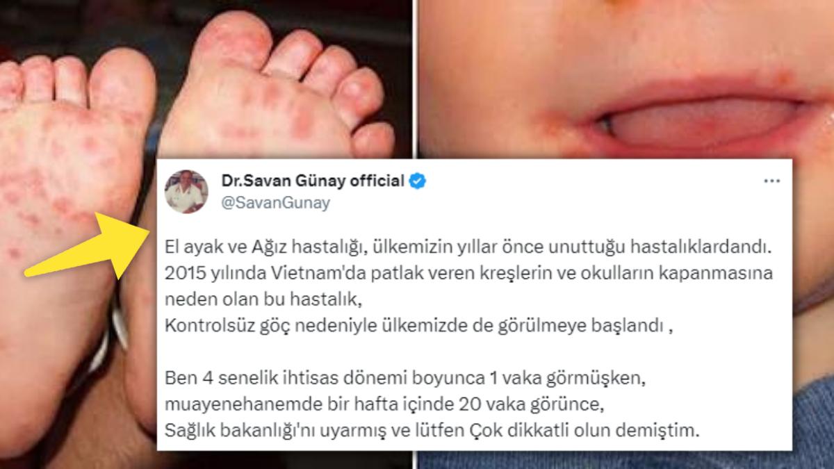 Sebebi "Düzensiz Göç" Olabilir mi? Son Vakitlerde Artan "El Ayak Ağız Hastalığı" Endişelendirdi!