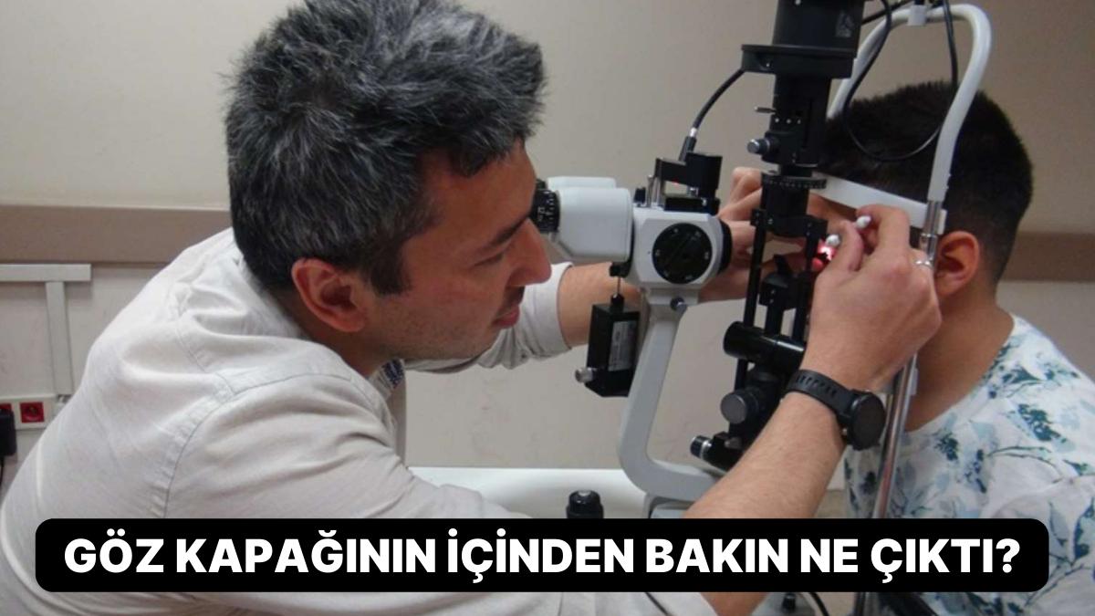 Böylesi Ne Görüldü Ne de Duyuldu: Göz Kapağının İçinden Bakın Ne Çıktı?