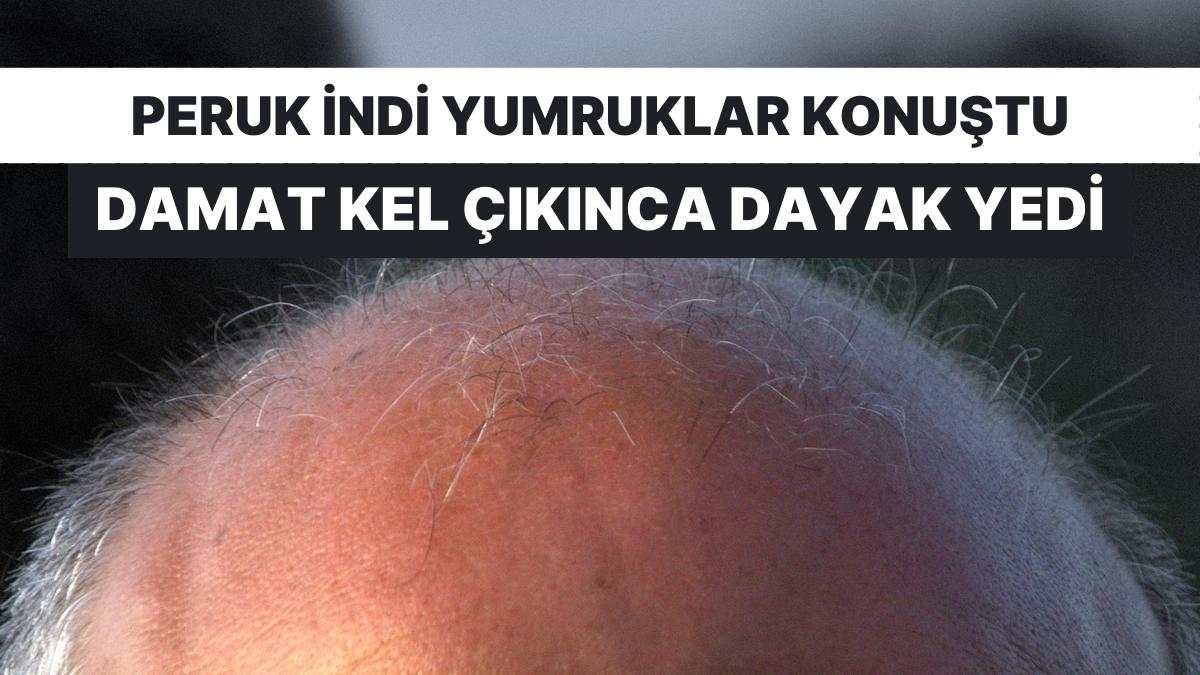 Kel Olduğu Anlaşılan Damat Düğünde Dayak Yedi