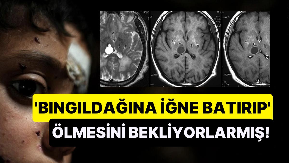 Ülkemizde Ailelerin İstenmeyen Çocukları Olduğunda Ölmesi için Azap Yaptıkları Gerçeği "Pes" Dedirtti