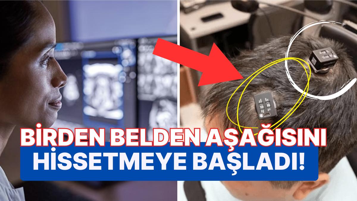 Yapay Zeka ile Beyin İrtibatı Yine Kurularak Güzelleşen Felçli Hastanın Yaşadıkları Hepimizi Dumur Etti